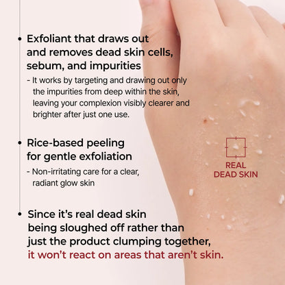 Struggling with Blackheads, Dead Skin & Dullness? | Our Gentle Exfoliating Peel Removes Impurities, Smooths Rough Texture & Restores a Radiant, Healthy Glow Instantly